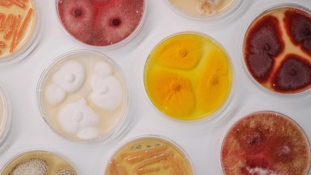 lab-fungi-petri-dish-Lyngby-DK-001