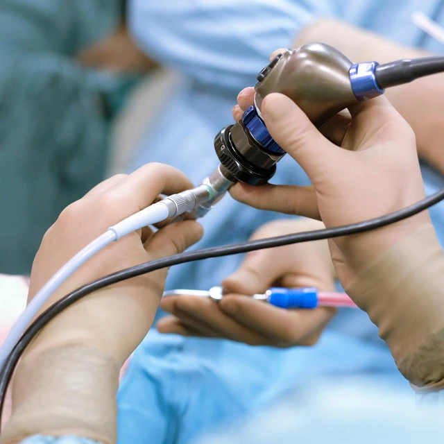 Surgeons with endoscopic camera during an operation