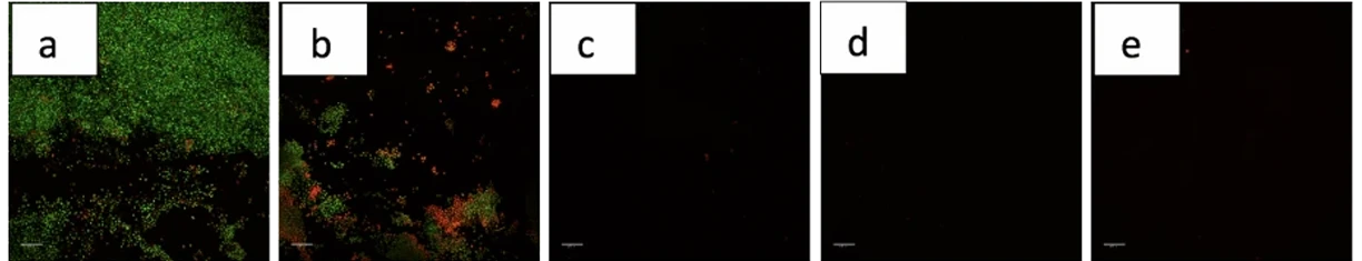 endoscope_challenge_Findings