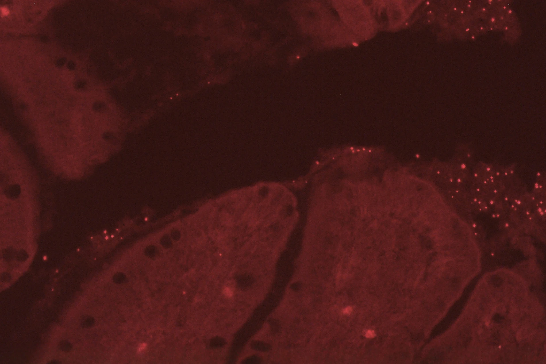 intestine microscope